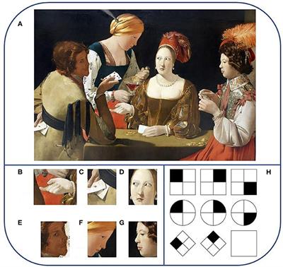 The Autism Palette: Combinations of Impairments Explain the Heterogeneity in ASD
